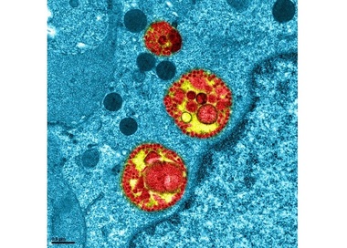 Oficialii chinezi au aşteptat mai mult de o săptămână, după ce laboratoarele au decodificat genomul noului coronavirus, pentru a transmite detalii - Raport