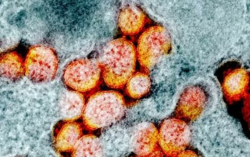 Bilanţul pandemiei de coronavirus - Mai mult de 8 milioane de cazuri la nivel mondial; peste 2 milioane în Europa