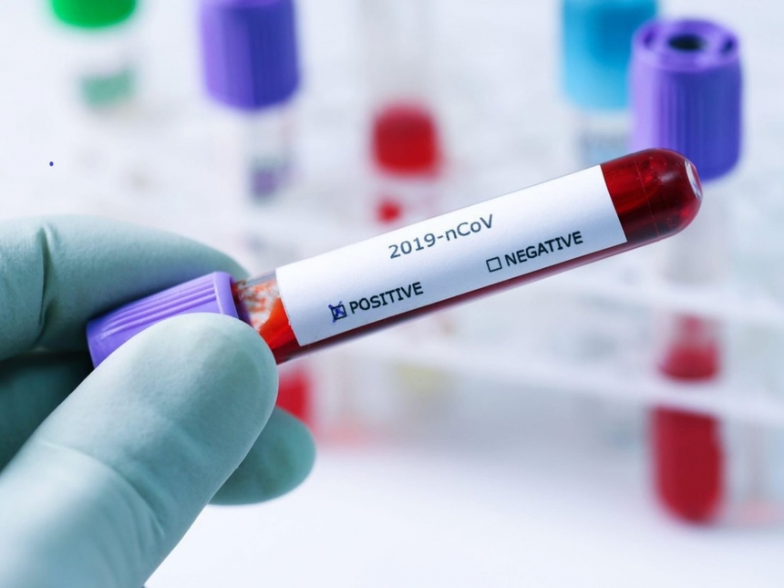 Reuters: Numărul cazurilor de infecţii cu noul coronavirus la nivel mondial a depăşit duminică 50 de milioane de cazuri