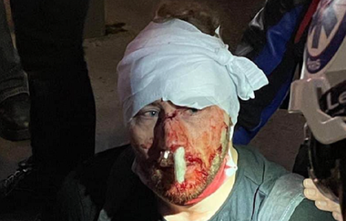 RSF denunţă ”violenţe inacceptabile ale poliţiei”, după rănirea unui jurnalist sirian la manifestaţiile împotriva proiectului legii ”securităţii globale”