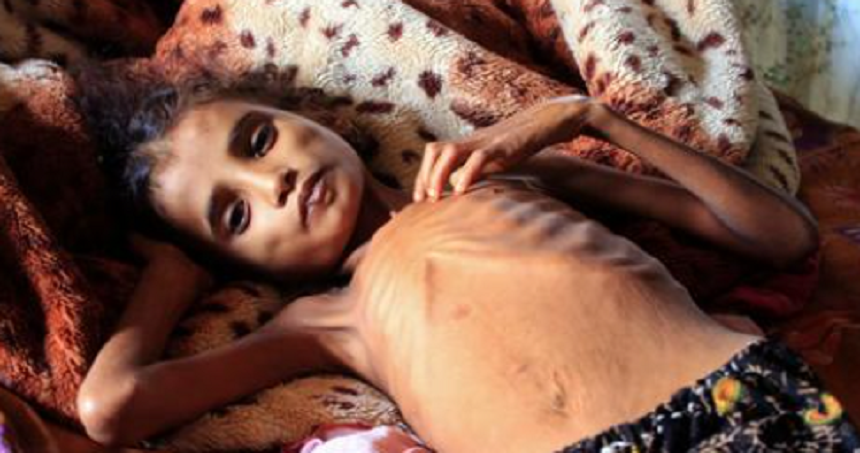 Secretarul general al ONU Antonio Guterres avertizează cu privire la riscul a ”milioane” de morţi din cauza foametei