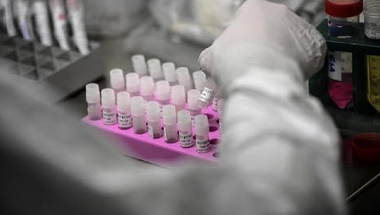 O variantă bretonă a noului coronavirus prezintă rezultate negative covid-19 la teste de referinţă precum PCR; varianta din Bretagne nu ar fi mai contagioasă şi nu ar cauza o boală mai gravă; autorităţile franceze testează reacţia variantei la vaccinare