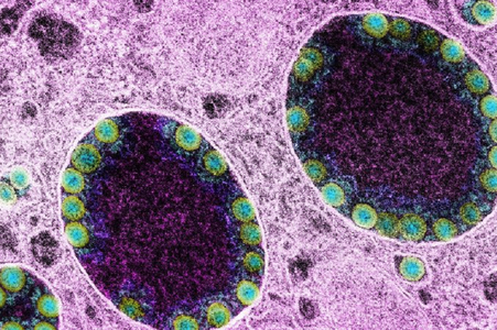 Două cazuri de gripă şi omicron, ”flurona”, la Budapesta, unde noua variantă este prezentă în 78% dintre eşantioanele analizate de către un laborator privat