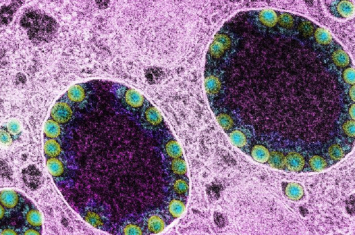 Austria a anunţat primul caz de "Flurona". Pacienta a fost vaccinată cu schema completă contra Covid-19, dar nu şi pentru gripă