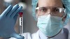 Fondul Global de Combatere a SIDA, Tuberculozei şi Malariei a strâns o treime din cele 18 miliarde de dolari necesare anulării regresului cauzat de COVID-19 şi combaterii SIDA, malariei şi tuberculozei