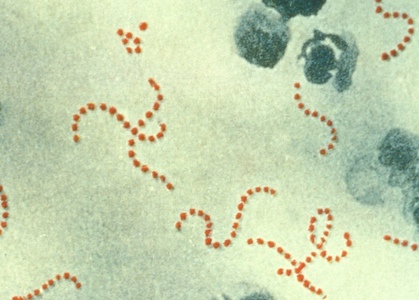 Şase copii au murit în Marea Britanie din cauza infecţiei cu streptococul A, care provoacă scarlatina