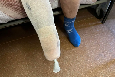 HRW avertizează Ucraina să nu mai folosească mine antipersonal, cere Kievului să deschidă o anchetă şi să-şi distrugă stocurile de mine antipersonal