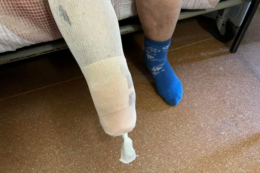 HRW avertizează Ucraina să nu mai folosească mine antipersonal, cere Kievului să deschidă o anchetă şi să-şi distrugă stocurile de mine antipersonal