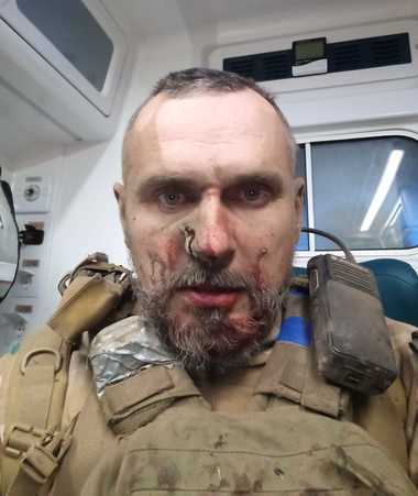 Cineastul ucrainean Oleg Senţov a fost rănit pe frontul din Zaporojie