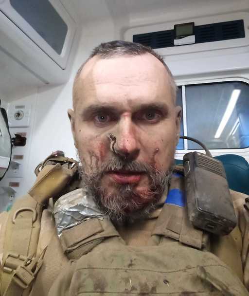 Cineastul ucrainean Oleg Senţov a fost rănit pe frontul din Zaporojie