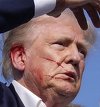 Rana la ureche suferită de Donald Trump se vindecă, afirmă fostul medic al Casei Albe. Glonţul a trecut la un centimetru de cap, spune Ronny Jackson