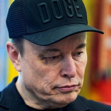 Micul X înscrie: Elon Musk a apărut cu vânătăi şi spune că fiul său cel mic l-a lovit