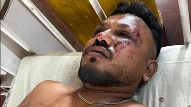 Tragedia aviatică din India - Un supravieţuitor al zborului a fost găsit în spital. El a stat pe scaunul 11A al aeronavei şi a povestit că problemele au început la 30 de secunde după decolare