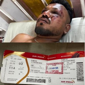 Supravieţuire miraculoasă. Un singur pasager al avionului prăbuşit în India a scăpat cu viaţă. Este locul 11A pe care a stat cel mai sigur dintr-un avion? 