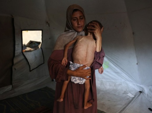 Un sfert dintre copiii de până la cinci ani şi femei însărcinate şi care alăptează, examinaţi de MSF în Fâşia Gaza în ultimele două săptămâni, suferă de malnutriţie. MSF denunţă ”o foamete deliberată, provocată de către autorităţile israeliene în campania genocidară în curs”