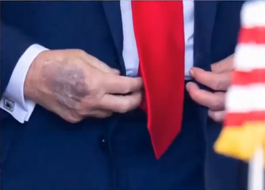 În faţa criticilor, Trump repetă că este „în perfectă sănătate”