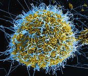 Ebola în RD Congo: 131 de decese estimate şi 513 cazuri suspecte. Directorul OMS se declară „profund îngrijorat de amploarea şi rapiditatea” epidemiei. Surse: testele defectuoase şi funeraliile au permis răspândirea virusului fără a fi detectat