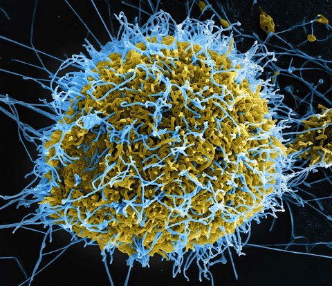 Ebola în RD Congo: 131 de decese estimate şi 513 cazuri suspecte. Directorul OMS se declară „profund îngrijorat de amploarea şi rapiditatea” epidemiei. Surse: testele defectuoase şi funeraliile au permis răspândirea virusului fără a fi detectat