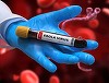 Virusul Ebola: Canada interzice intrarea străinilor care au stat în RD Congo în ultimele 21 de zile