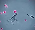 Un turist care a tranzitat Franţa în a doua jumătate a lunii iulie a fost testat pozitiv la tulpina Andes de hantavirus, în timp ce franţuzoaica infectată cu hantavirus în epidemia din primăvară a ieşit din terapie intensivă după trei luni