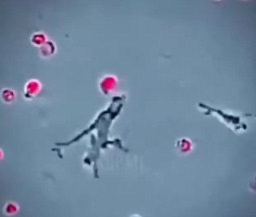 Un turist care a tranzitat Franţa în a doua jumătate a lunii iulie a fost testat pozitiv la tulpina Andes de hantavirus, în timp ce franţuzoaica infectată cu hantavirus în epidemia din primăvară a ieşit din terapie intensivă după trei luni