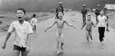 Rănile celebrei ”Napalm Girl”, vindecate cu ajutorul unui tratament revoluţionar cu laser, în Miami