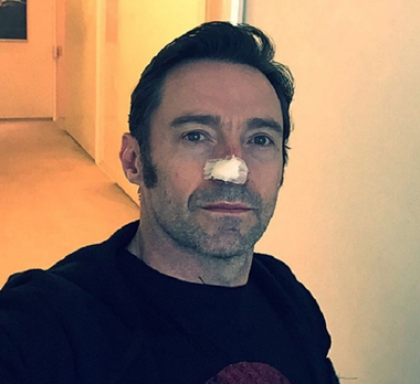 Actorul Hugh Jackman a fost operat pentru a şasea oară pentru extirparea unor celule care cauzează cancer de piele