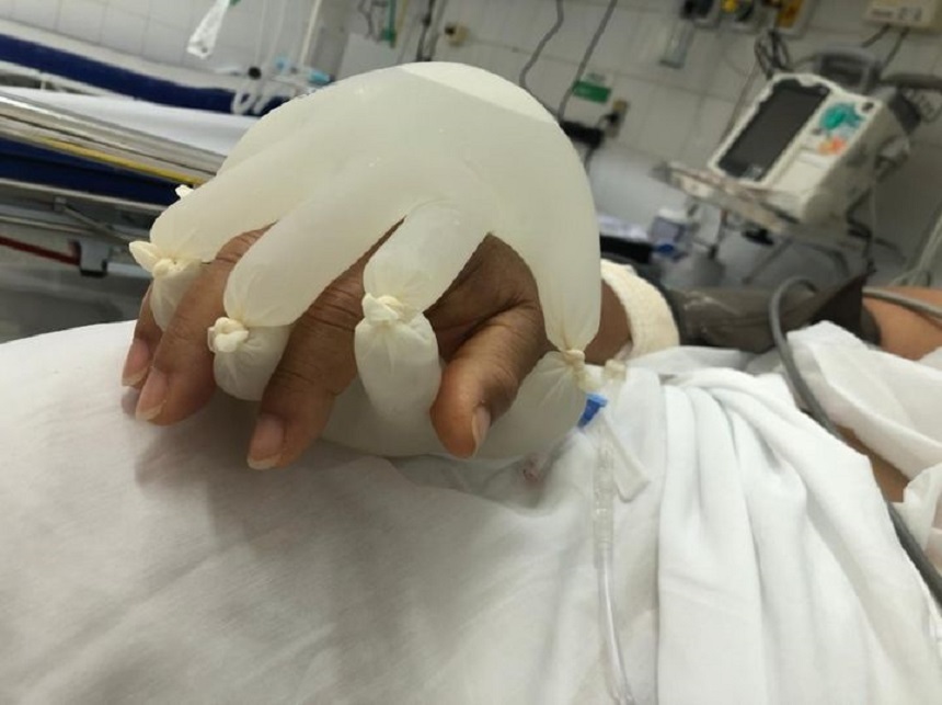 Imagine dintr-o secţie de terapie intensivă a unui spital din Brazilia, devenită virală