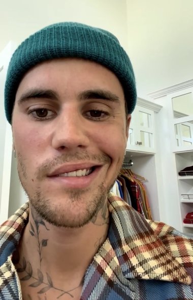 Justin Bieber suferă de paralizie facială cauzată de sindromul Ramsay Hunt - VIDEO 