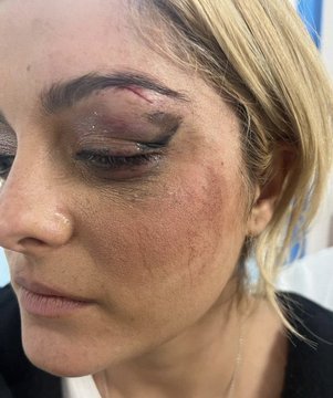 Cântăreaţa Bebe Rexha, scoasă de pe scenă la New York după ce un fan i-a aruncat un telefon în faţă - VIDEO
