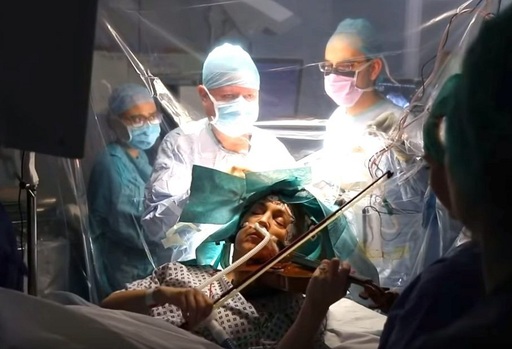 O violonistă a cântat în timpul operaţiei sale pe creier pentru a evita pierderea abilităţii la mâna stângă - VIDEO