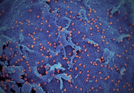 SARS-CoV-2 nu a fost creat de om cu elemente din HIV - studiu