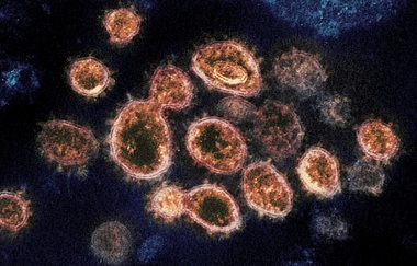 Famotidina, medicament utilizat în tratamentul ulcerului gastroduodenal, poate fi eficient în cazul Covid-19

