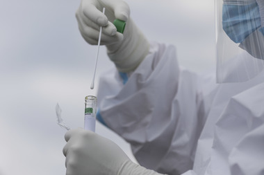 Omicron supravieţuieşte mai mult timp pe plastic şi piele faţă de variantele anterioare. Testarea nazală, cea mai bună - studiu