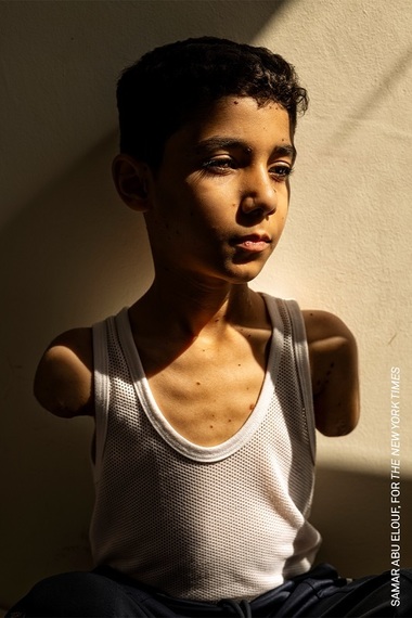 World Press Photo 2025 - Imaginea anului spune povestea unui băiat de 9 ani grav rănit în Gaza. Expoziţia internaţională ajunge şi anul acesta la Bucureşti, în luna mai