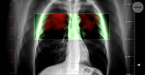 Nature - Ar putea o pastilă să prevină cel mai mortal tip de cancer din lume?/ VIDEO