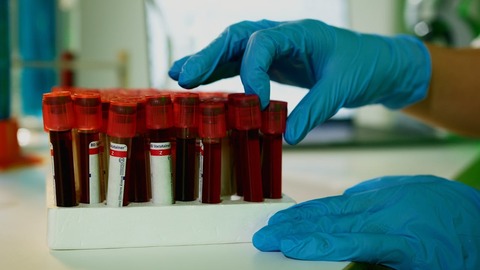 Inteligenţa artificială ar putea „citi” mult mai mult din analizele uzuale de sânge. Un model poate estima mii de biomarkeri moleculari
