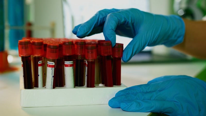 Inteligenţa artificială ar putea „citi” mult mai mult din analizele uzuale de sânge. Un model poate estima mii de biomarkeri moleculari
