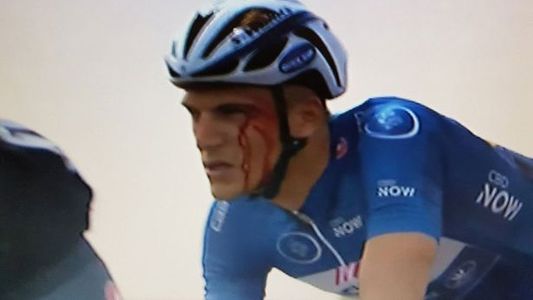 Marcel Kittel, cu arcada spartă după ce fost lovit în faţă de Andrei Grivko, în etapa a III-a a Turului Dubaiului