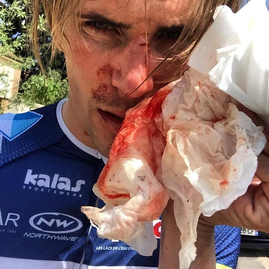 Ciclistul francez Yoann Offredo a fost bătut cu o bâtă de baseball