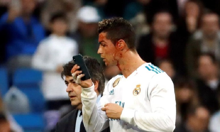 Cristiano Ronaldo a cerut un telefon mobil pentru a vedea cât de tare a sângerat, după o lovitură primită la meciul cu La Coruna