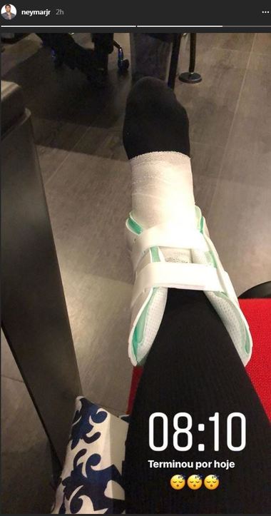 Neymar a suferit o entorsă şi o fisură de metatarsian