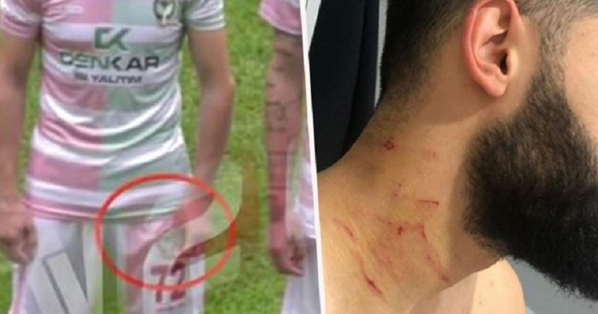 Turcia: Suspendare pe viaţă pentru un fotbalist care a rănit patru adversari folosind o lamă de ras, la un meci din liga a treia - VIDEO