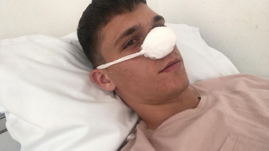Poli Iaşi: Ştefan Târnovanu a fost operat cu succes