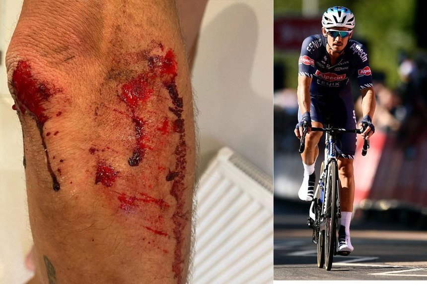 Ciclistul britanic Alexandar Richardson, agresat şi jefuit cu violenţă de bărbaţi mascaţi în timpul unui antrenament