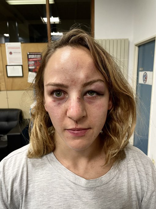Judoka Margaux Piont, campioană olimpică la Tokyo, spune că a fost bătută de antrenorul ei