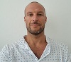 Norvegianul Aksel Lund Svindal, dublu campion olimpic la schi, are cancer la testicule