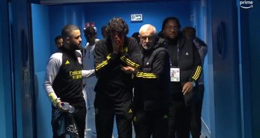 Liga Profesionistă de Fotbal din Franţa a deschis o anchetă ce vizează comportamentul suporterilor echipei Olympique Lyon la meciul cu Olympique Marseille
