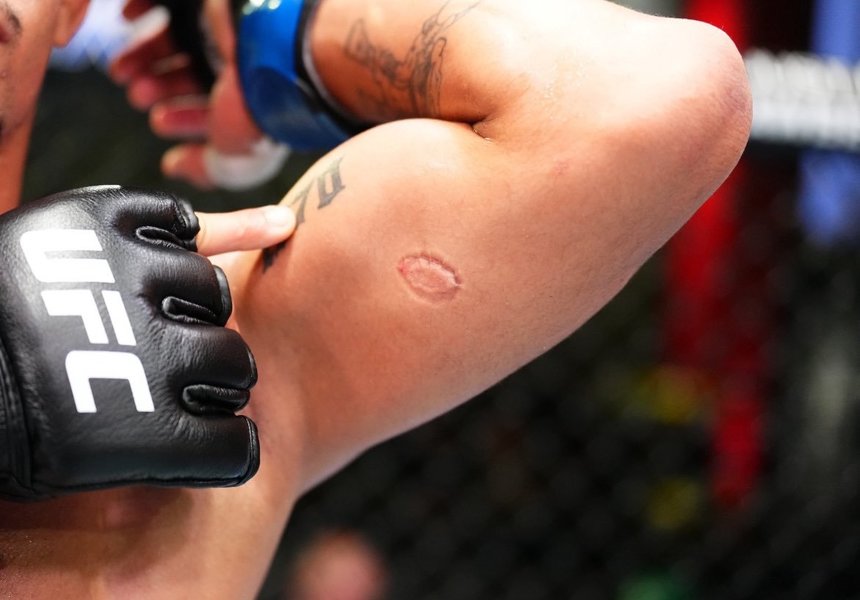 UFC Fight Night: Igor Severino a fost descalificat pentru că l-a muşcat de braţ pe Andre Lima