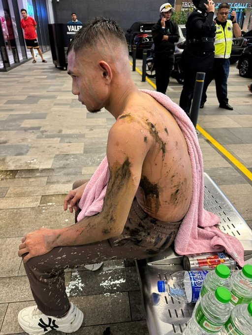 Malaysia: Un fotbalist a fost rănit într-un atac cu acid la un centru comercial